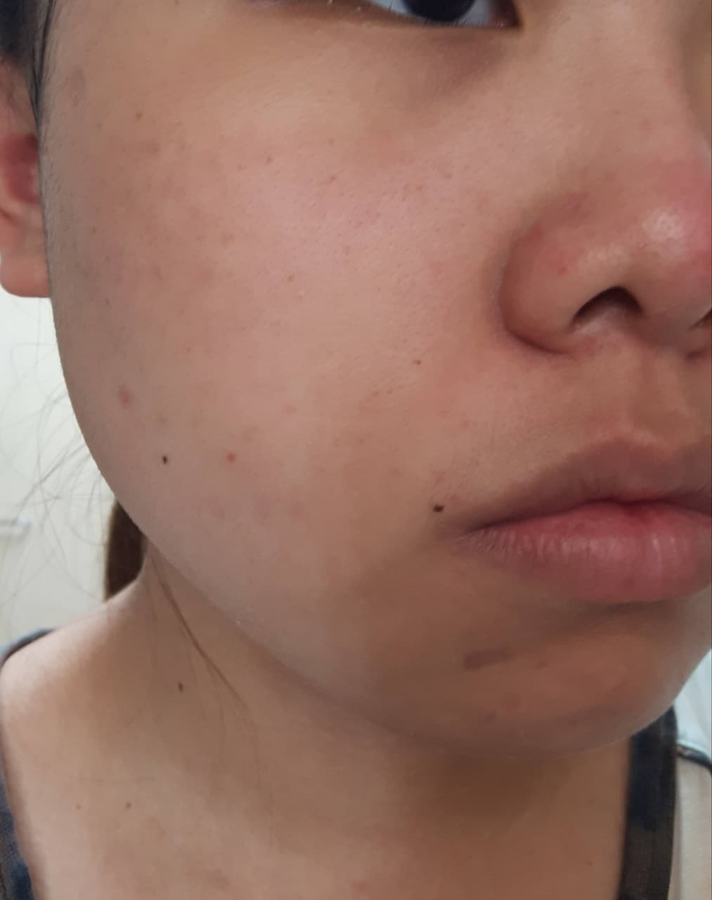 megapx