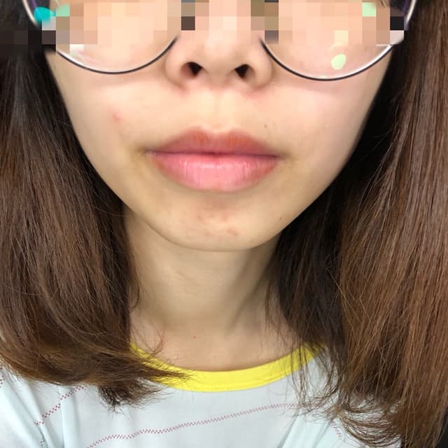 megapx