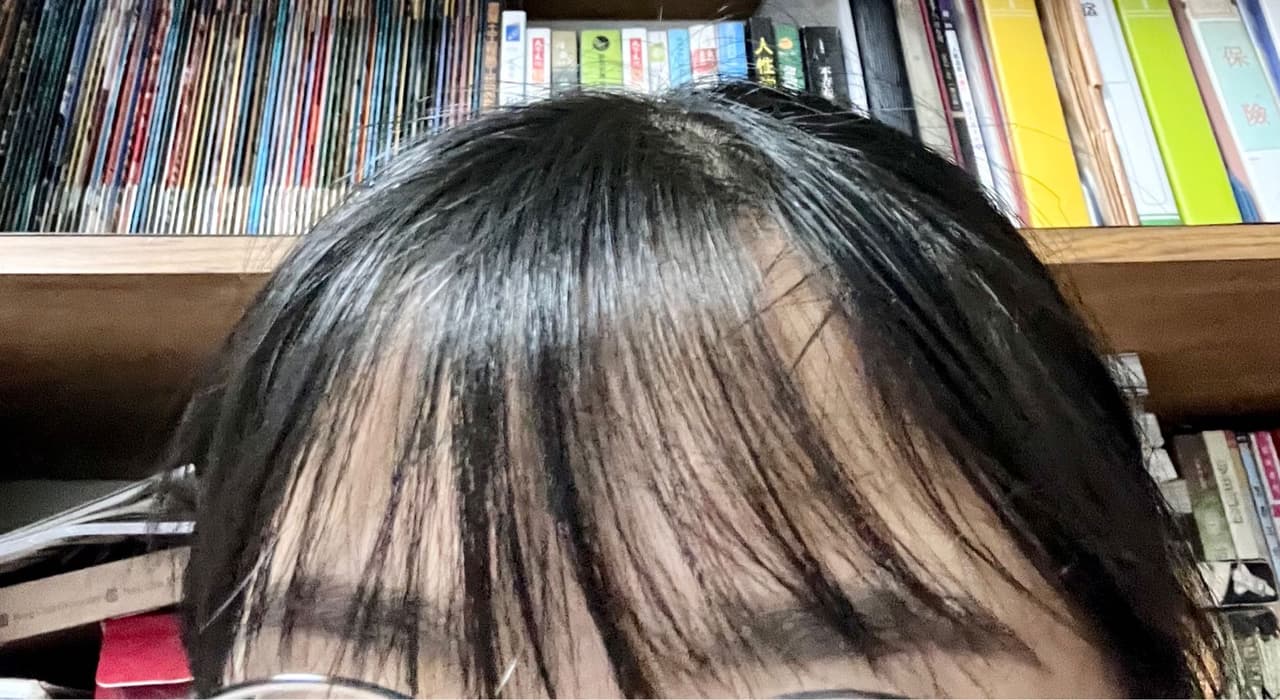 megapx