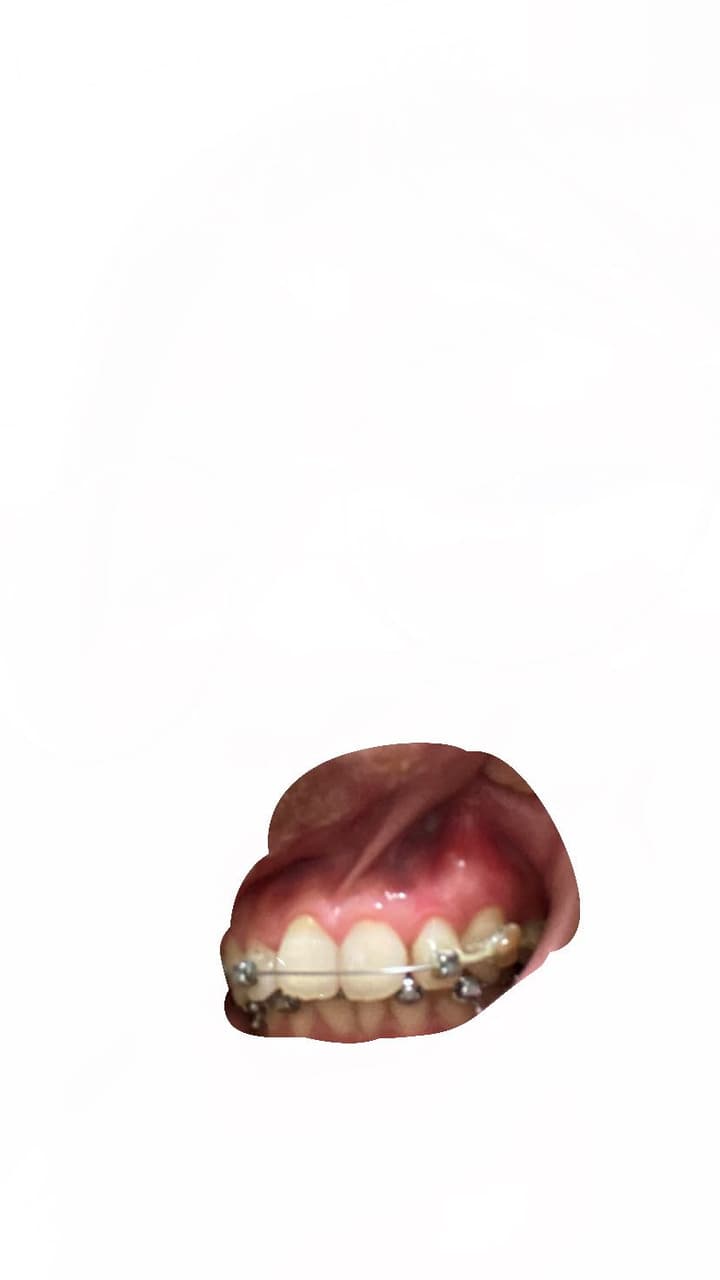 megapx