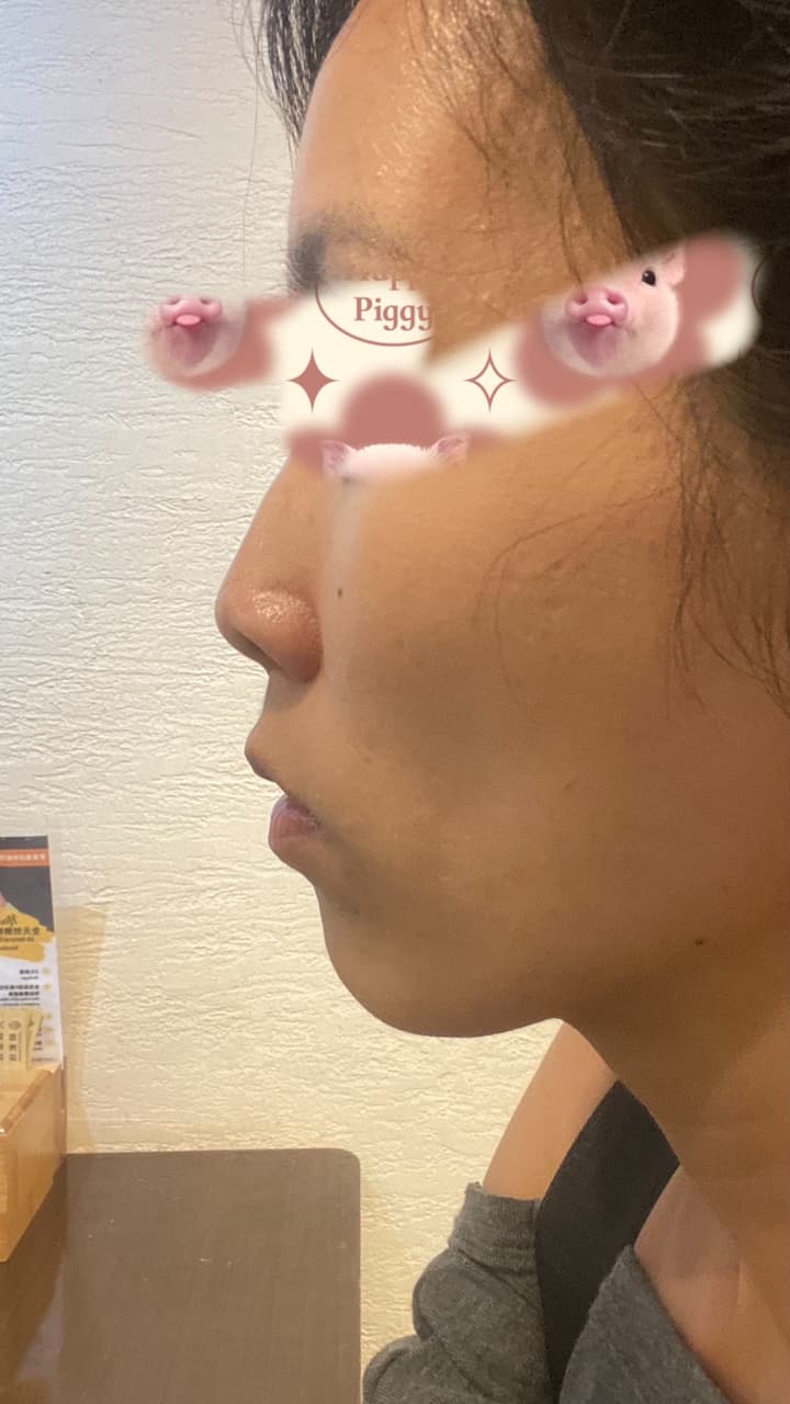 megapx