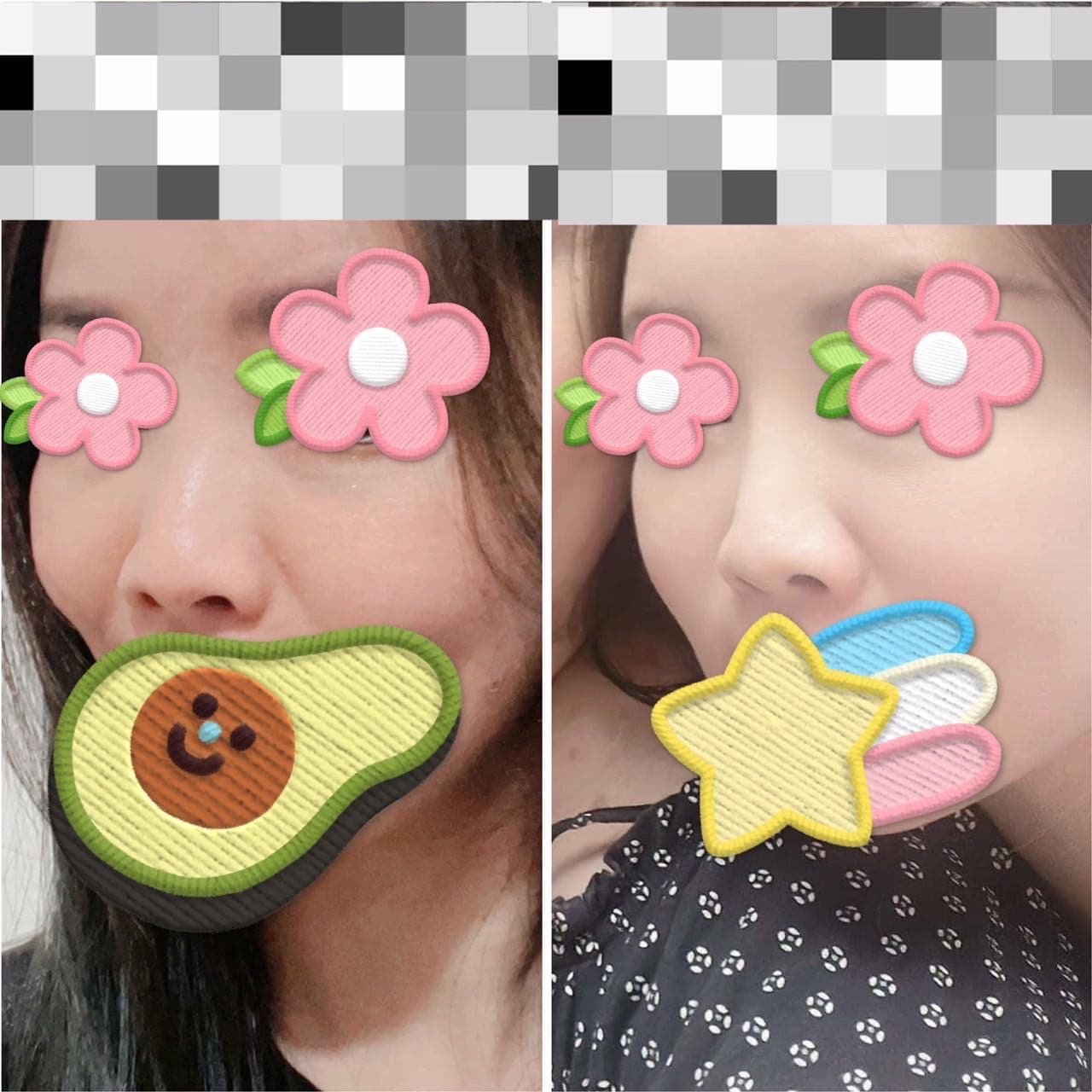 megapx
