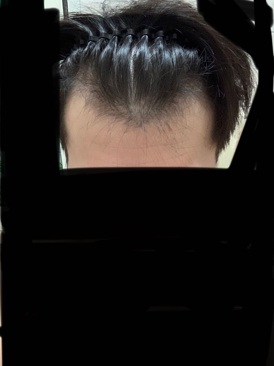 吃波斯卡,教你切?不用切藥器啊(抗禿實測 - 心情板 | Dcard
