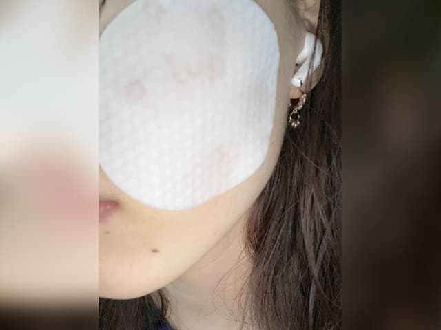 megapx