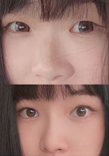 megapx