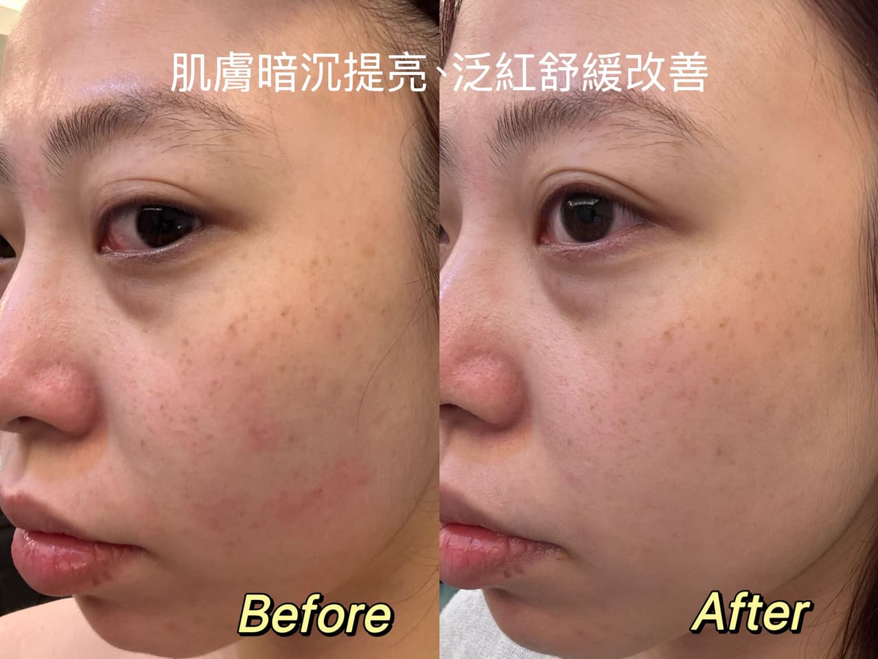 使用前後對照表
