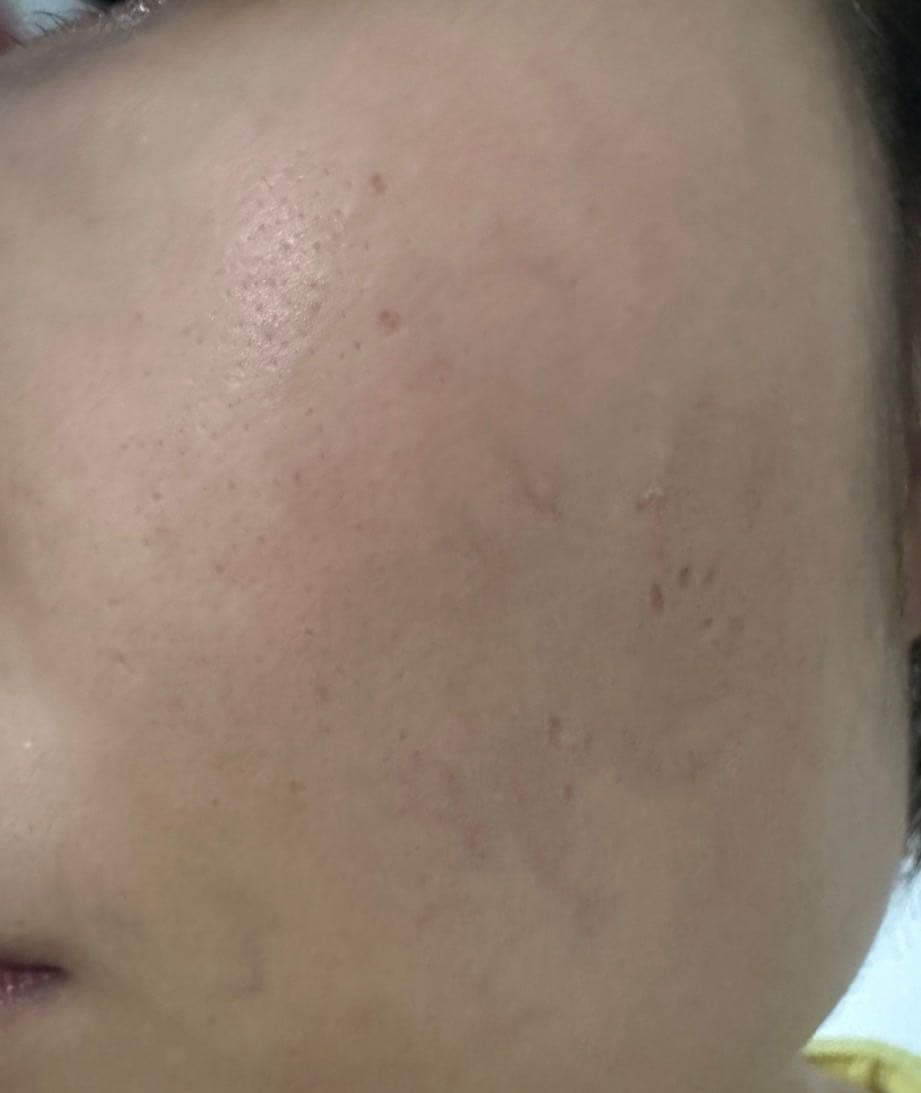 megapx