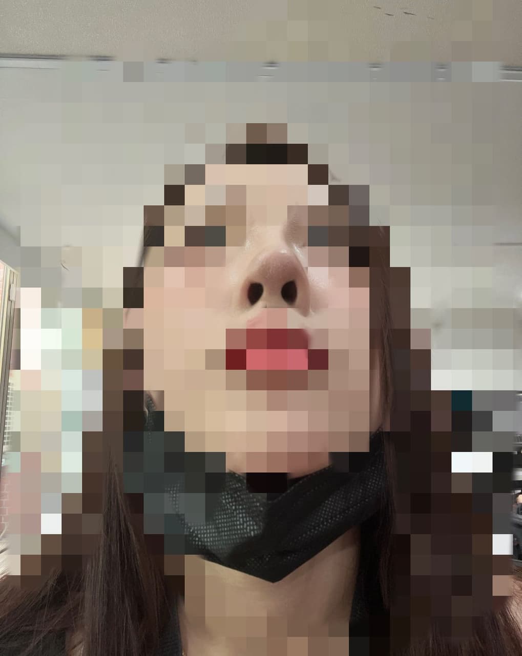 megapx