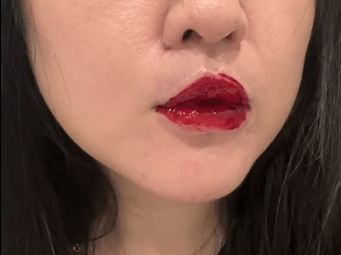 megapx