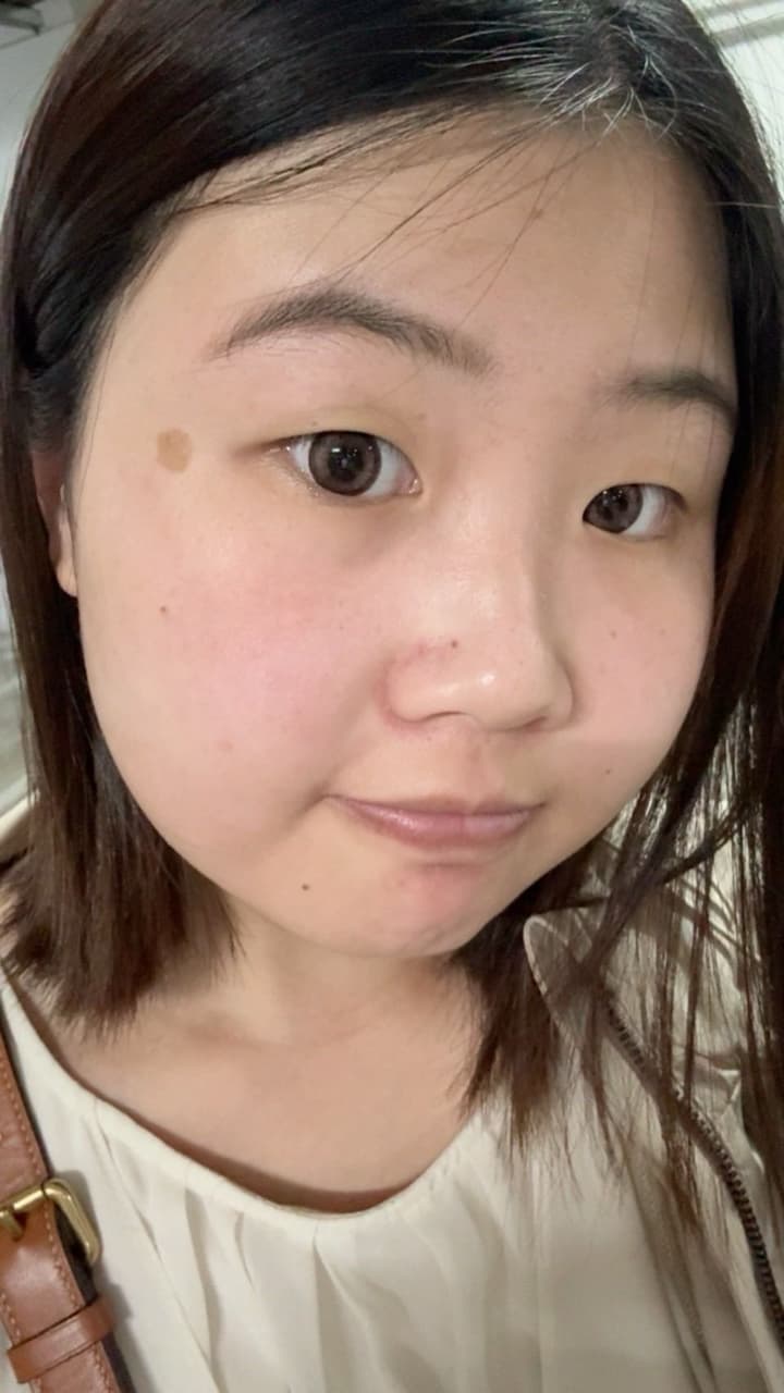 megapx