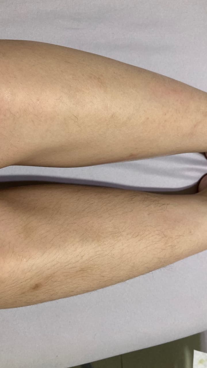 分享貝拉美人蜜糖蜜蠟除毛- 美妝板| Dcard