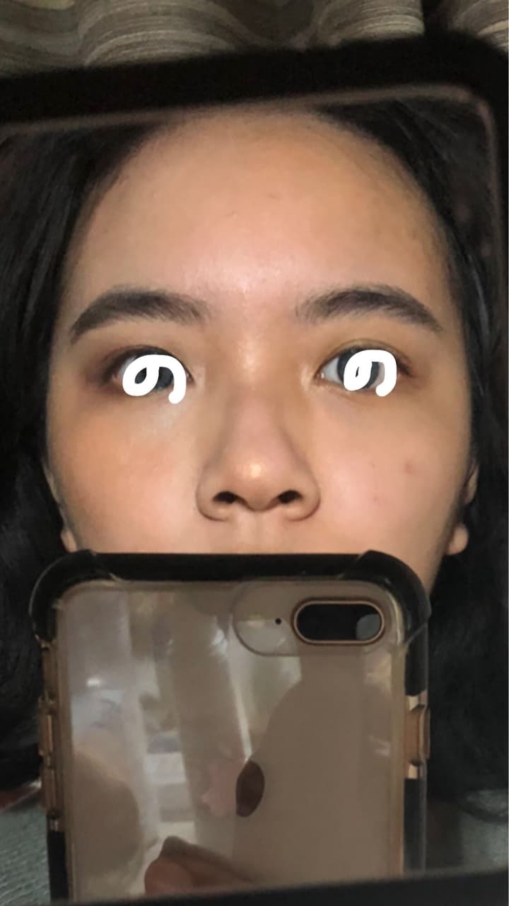 megapx