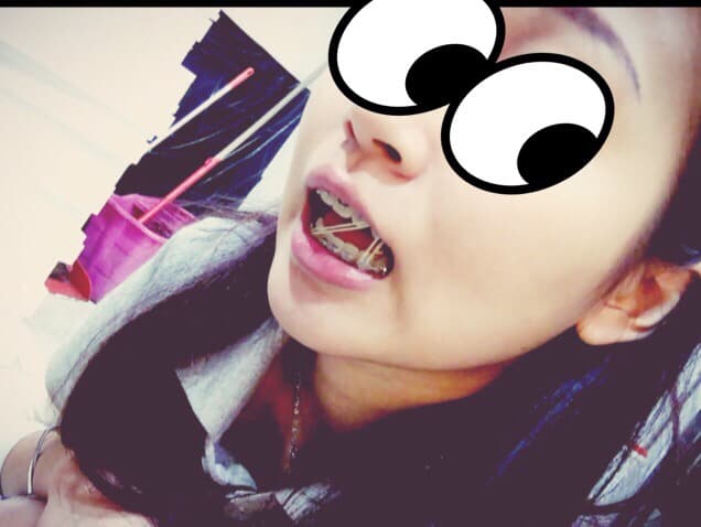 megapx