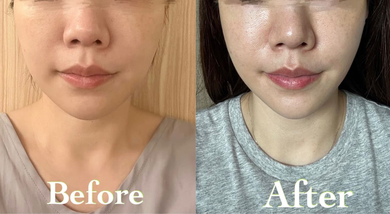 分享有感的瘦臉小物分享🥰 - 美妝板| Dcard