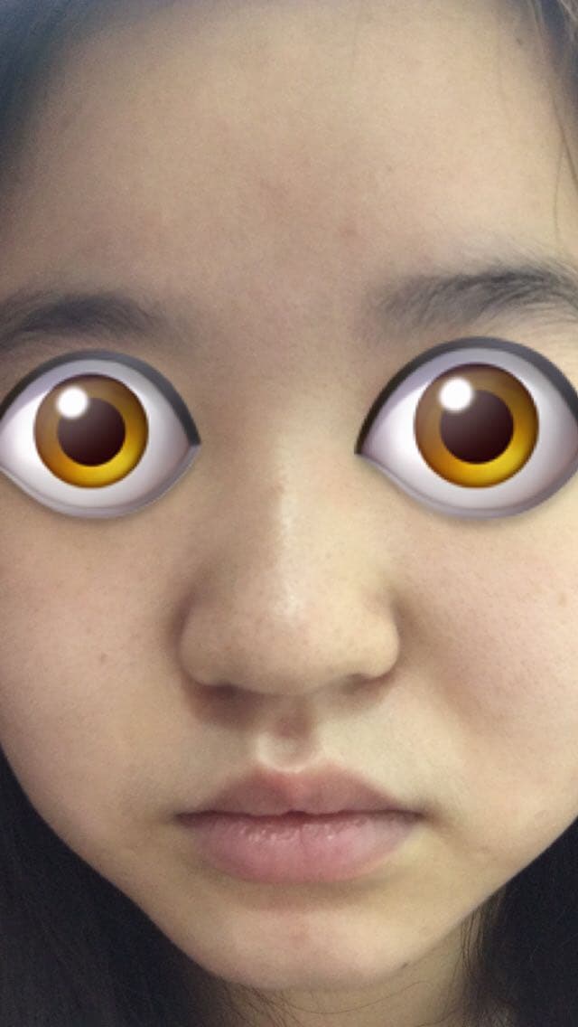 megapx