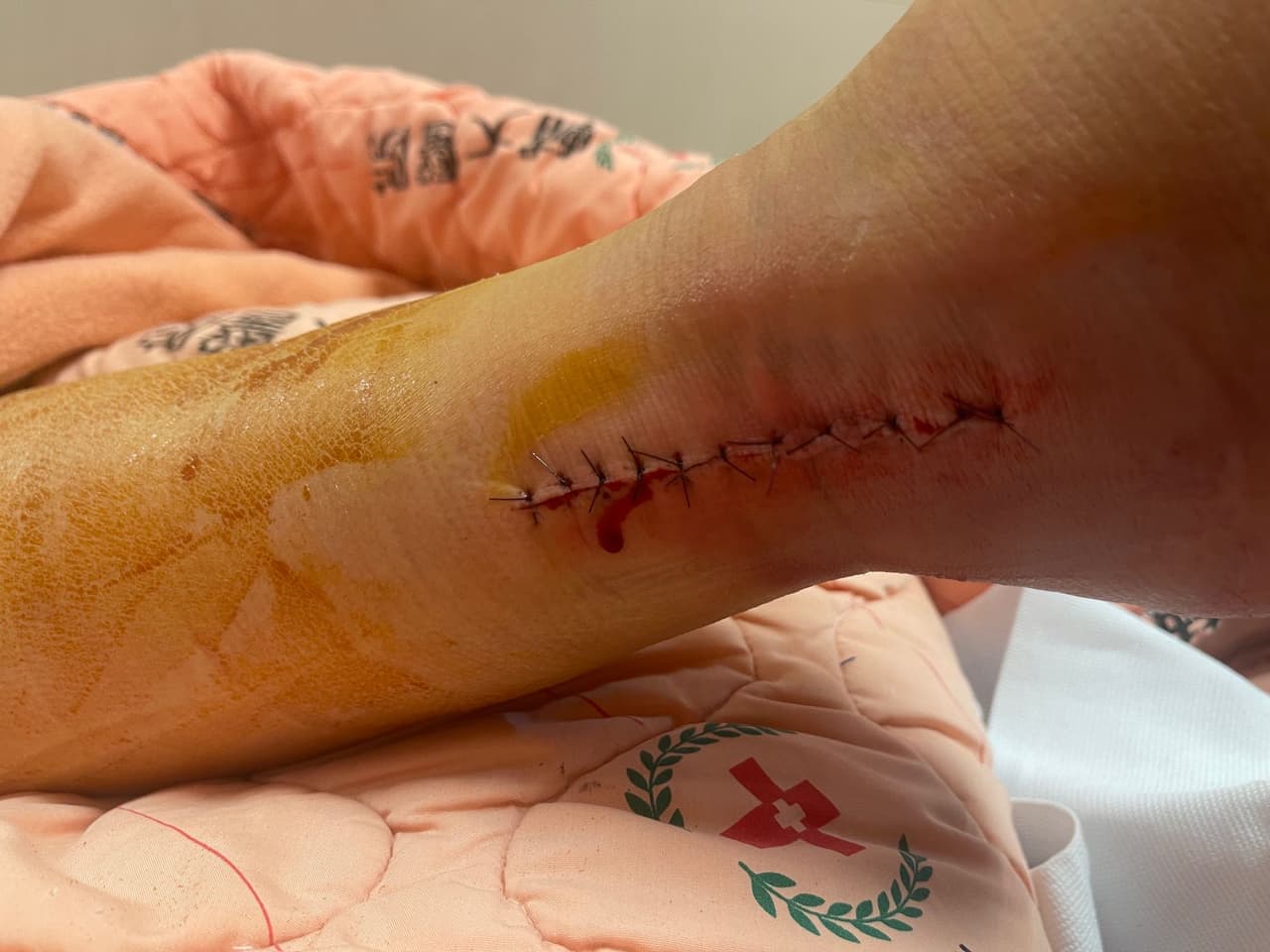 megapx