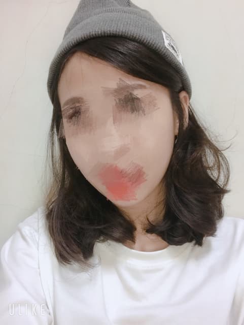 megapx