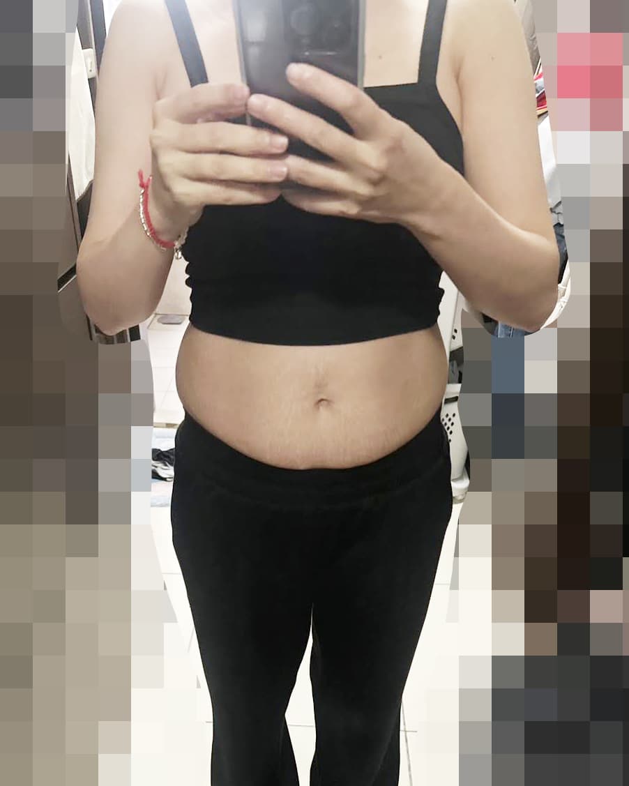 megapx