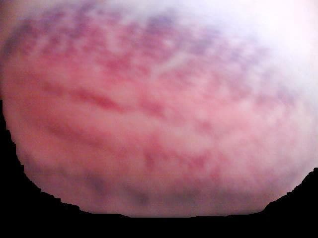 megapx