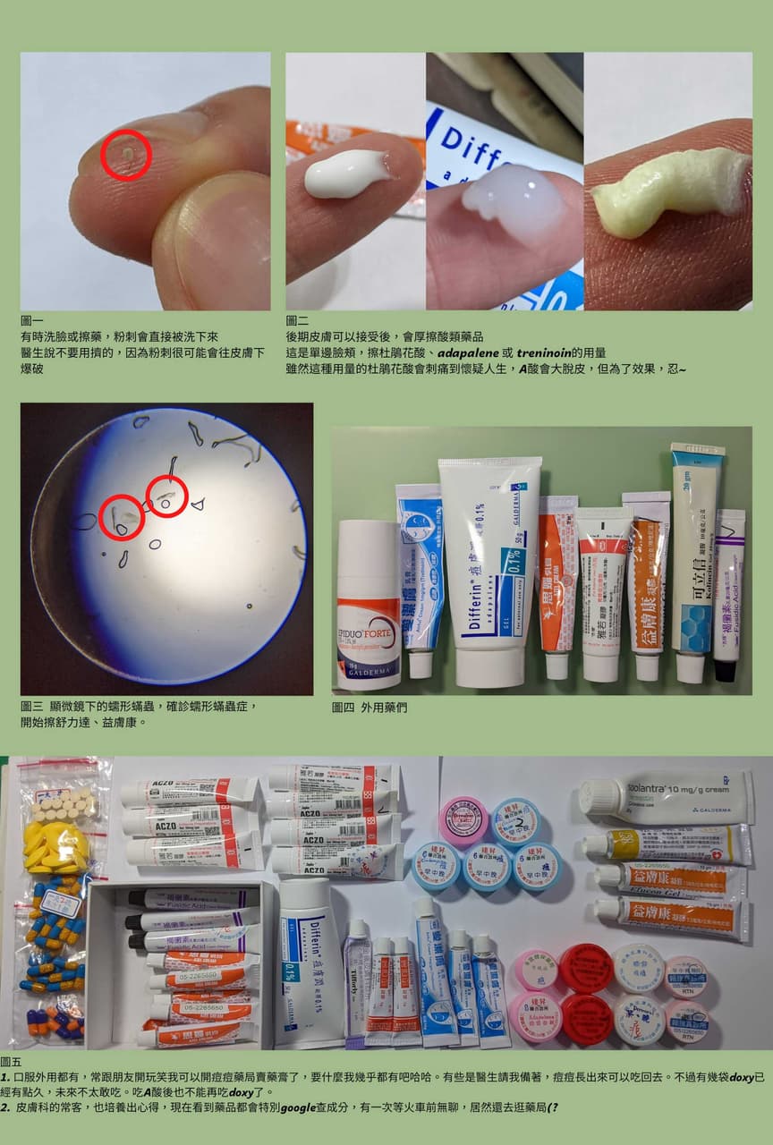 討論獻給痘痘戰友們口服A酸外用A酸Epiduo forte 痘痘- 美妝板| Dcard