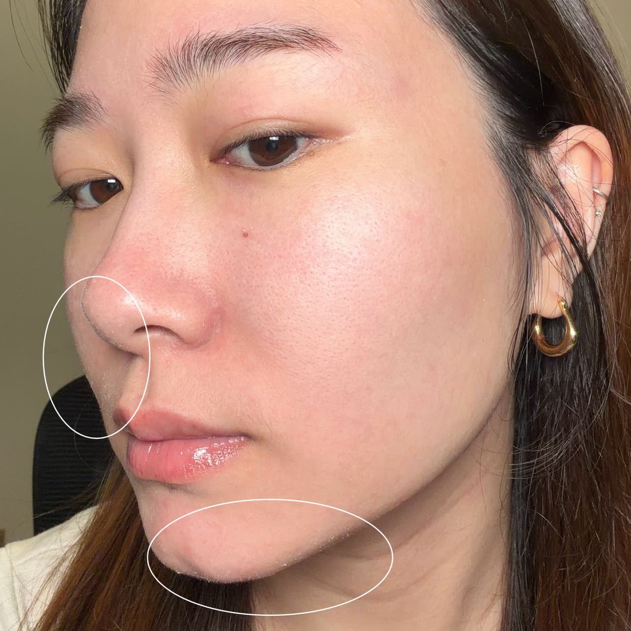 megapx