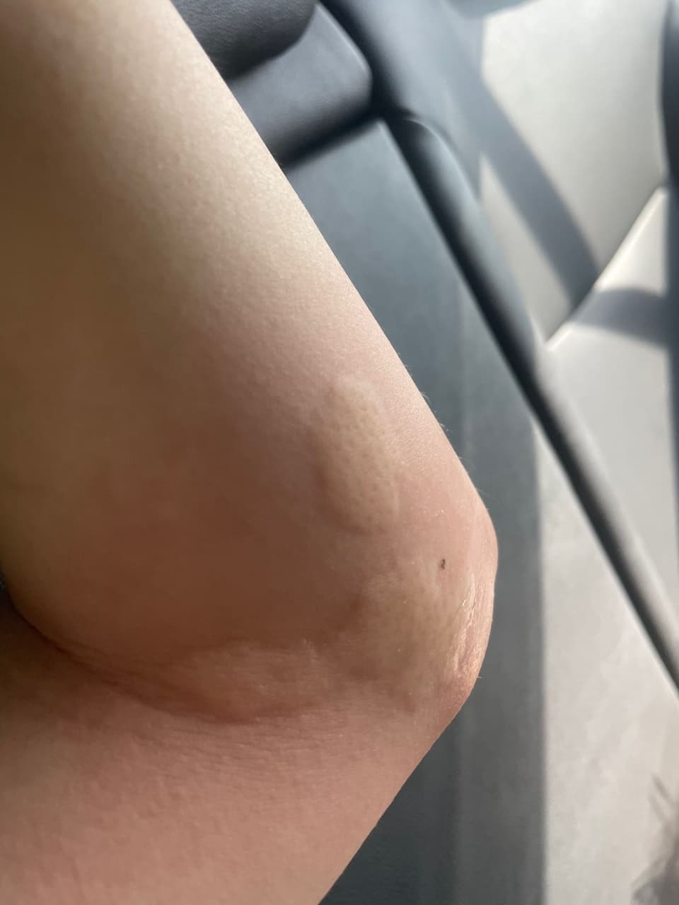 更我被小黑蚊圍毆- 閒聊板| Dcard