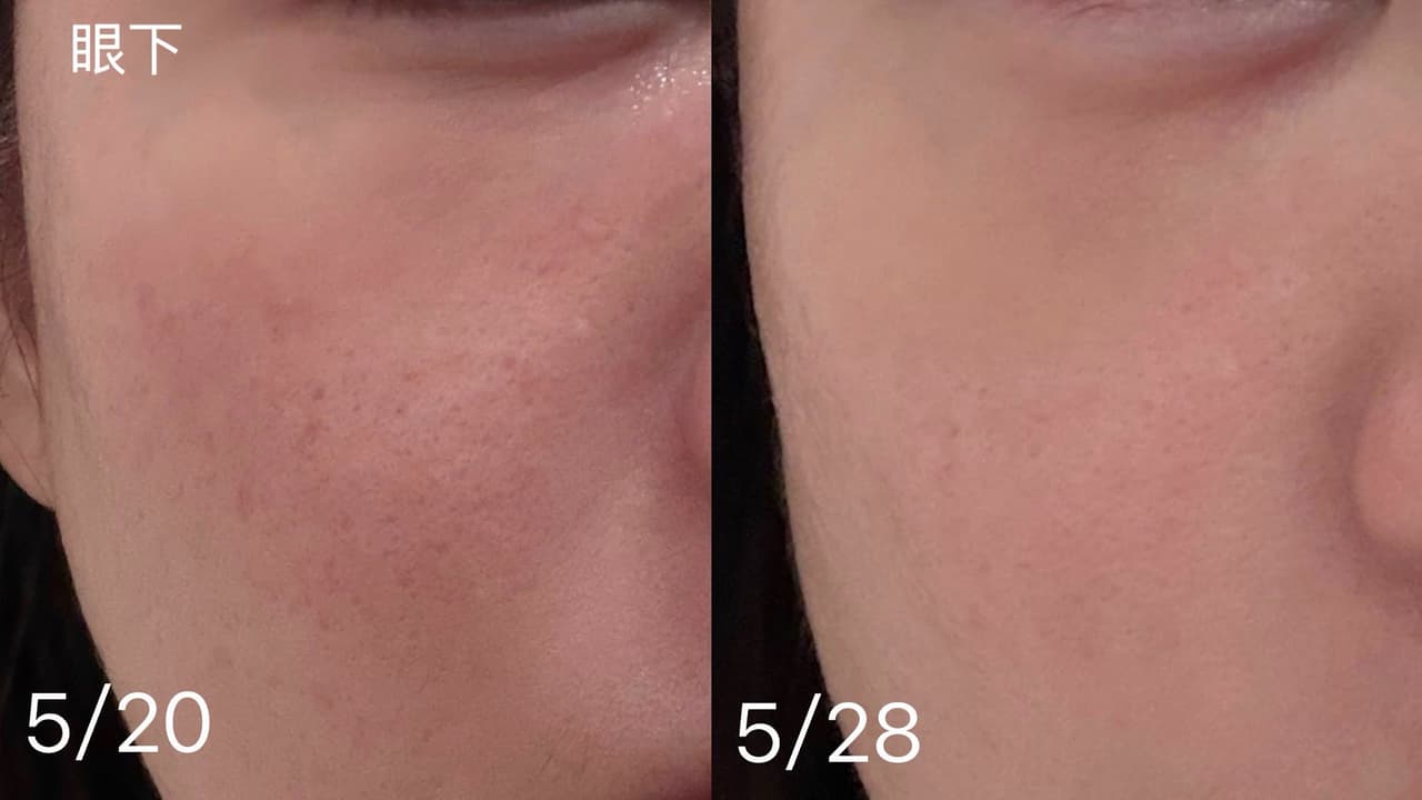 megapx