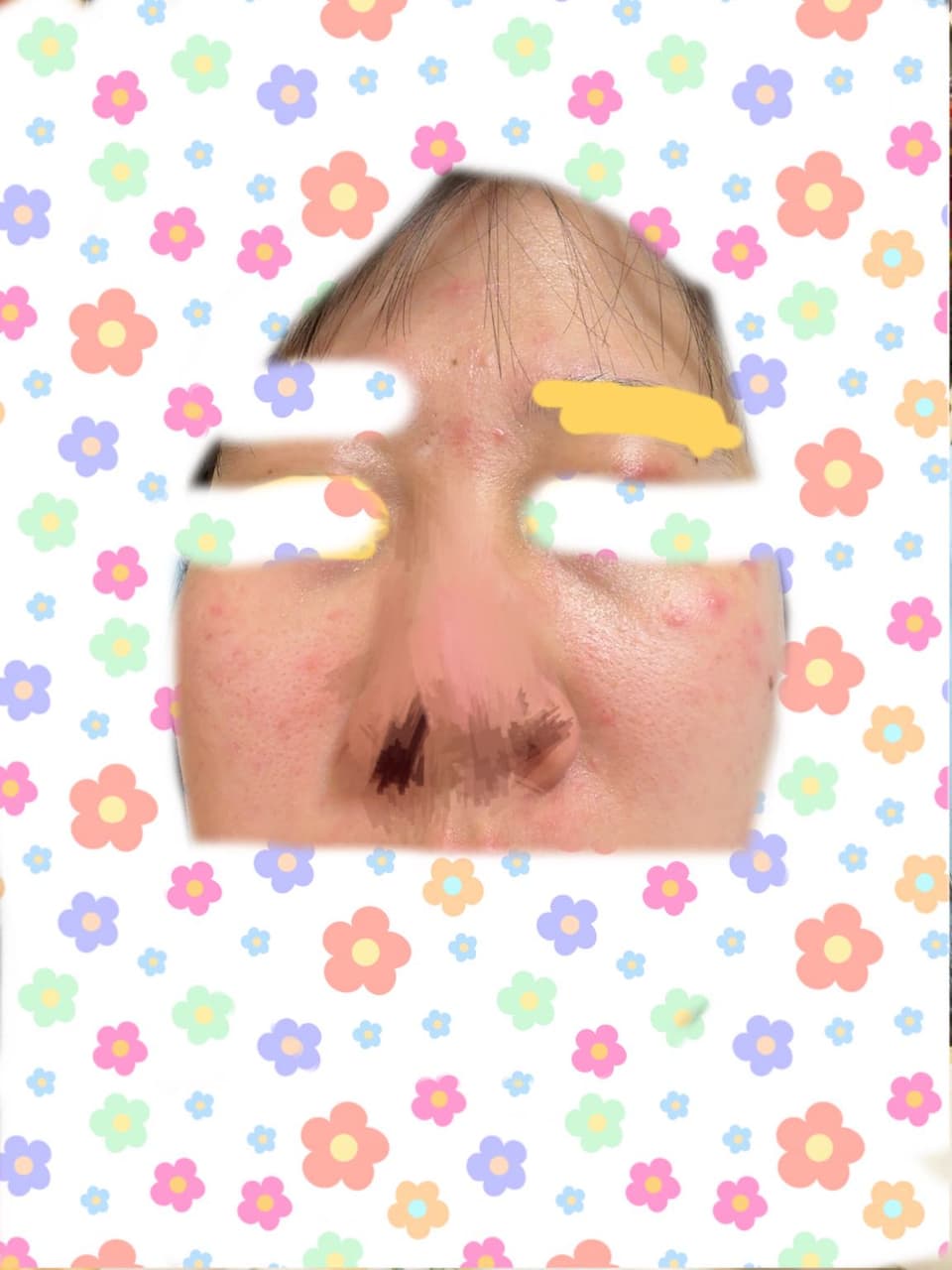 megapx