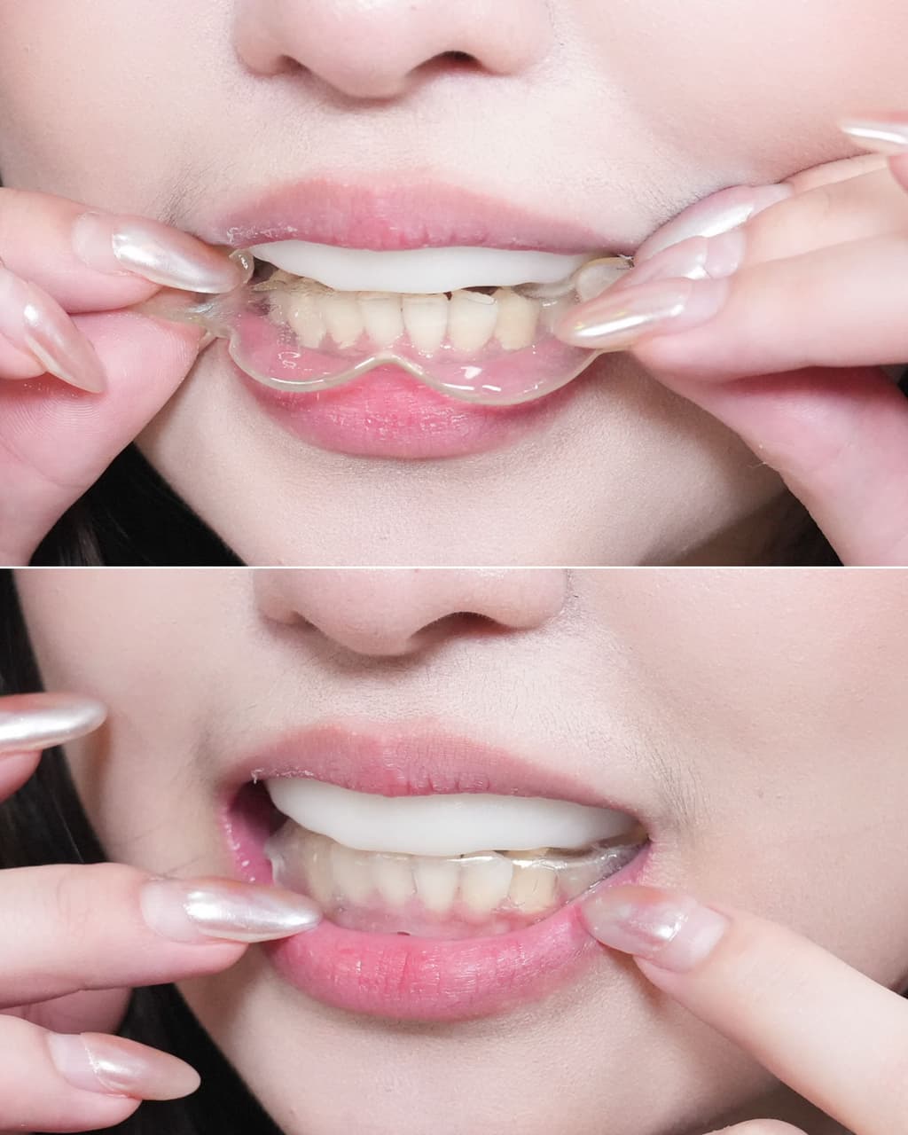 megapx