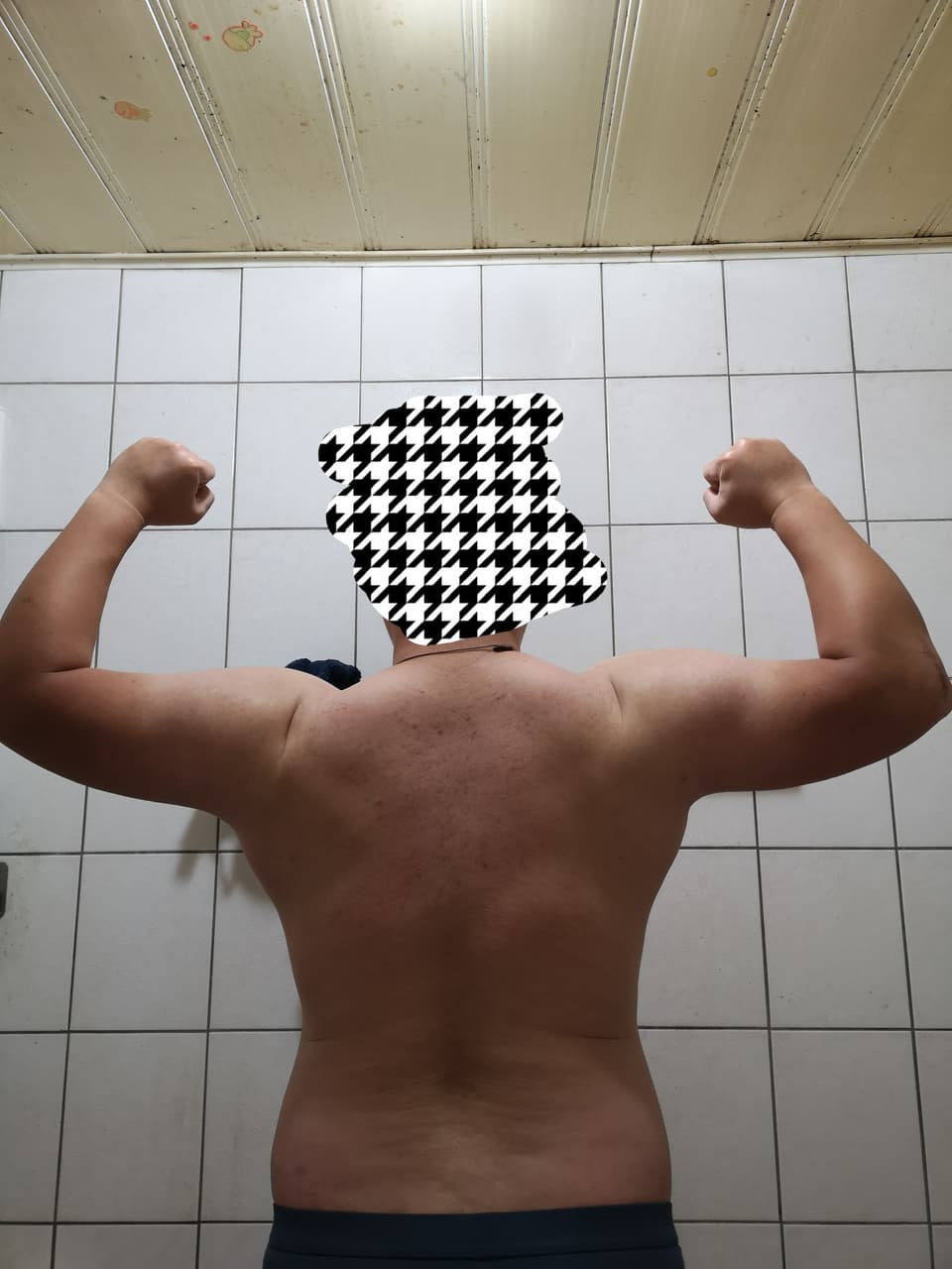 megapx
