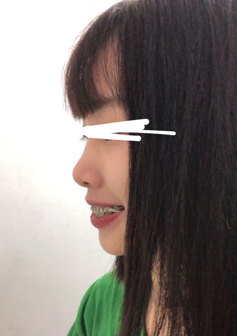 megapx