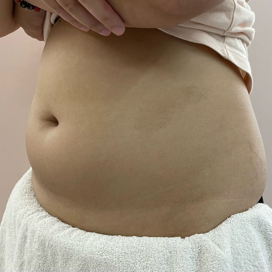 megapx