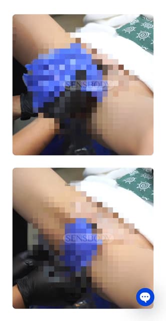 megapx