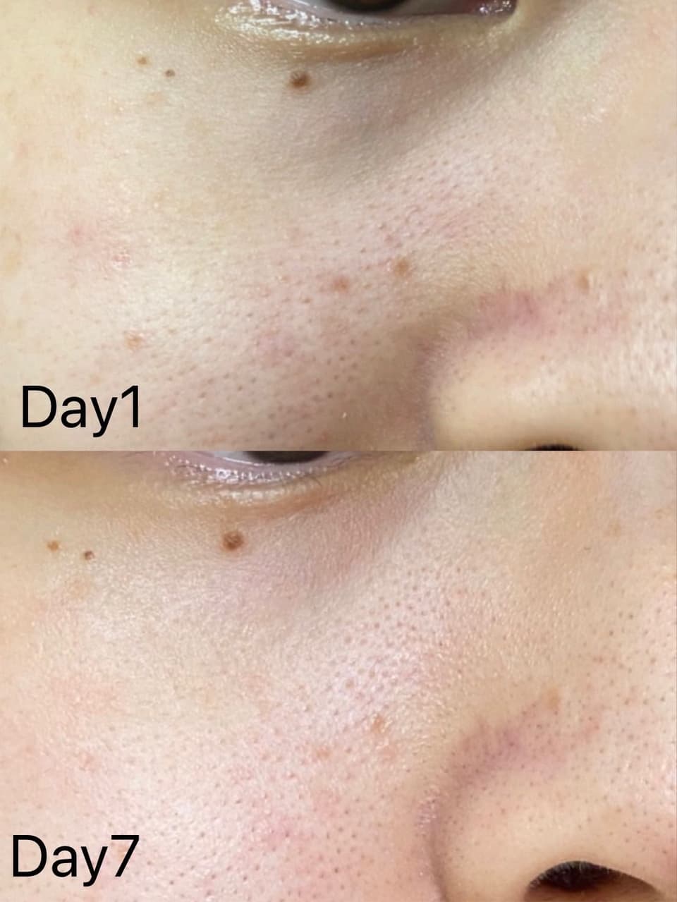 megapx