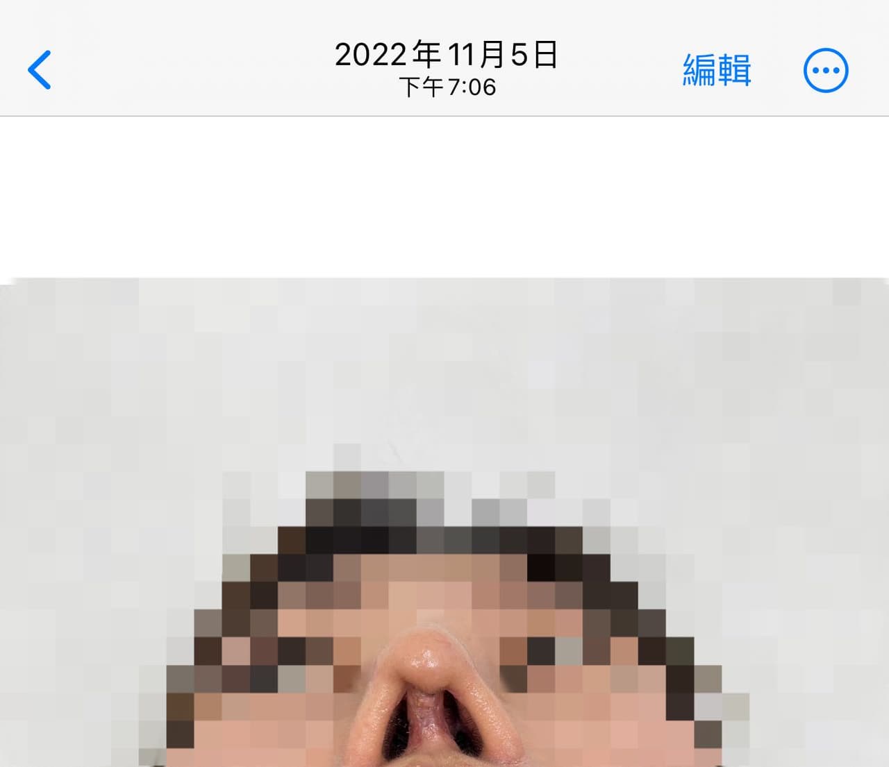 megapx