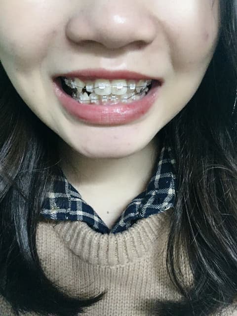 megapx