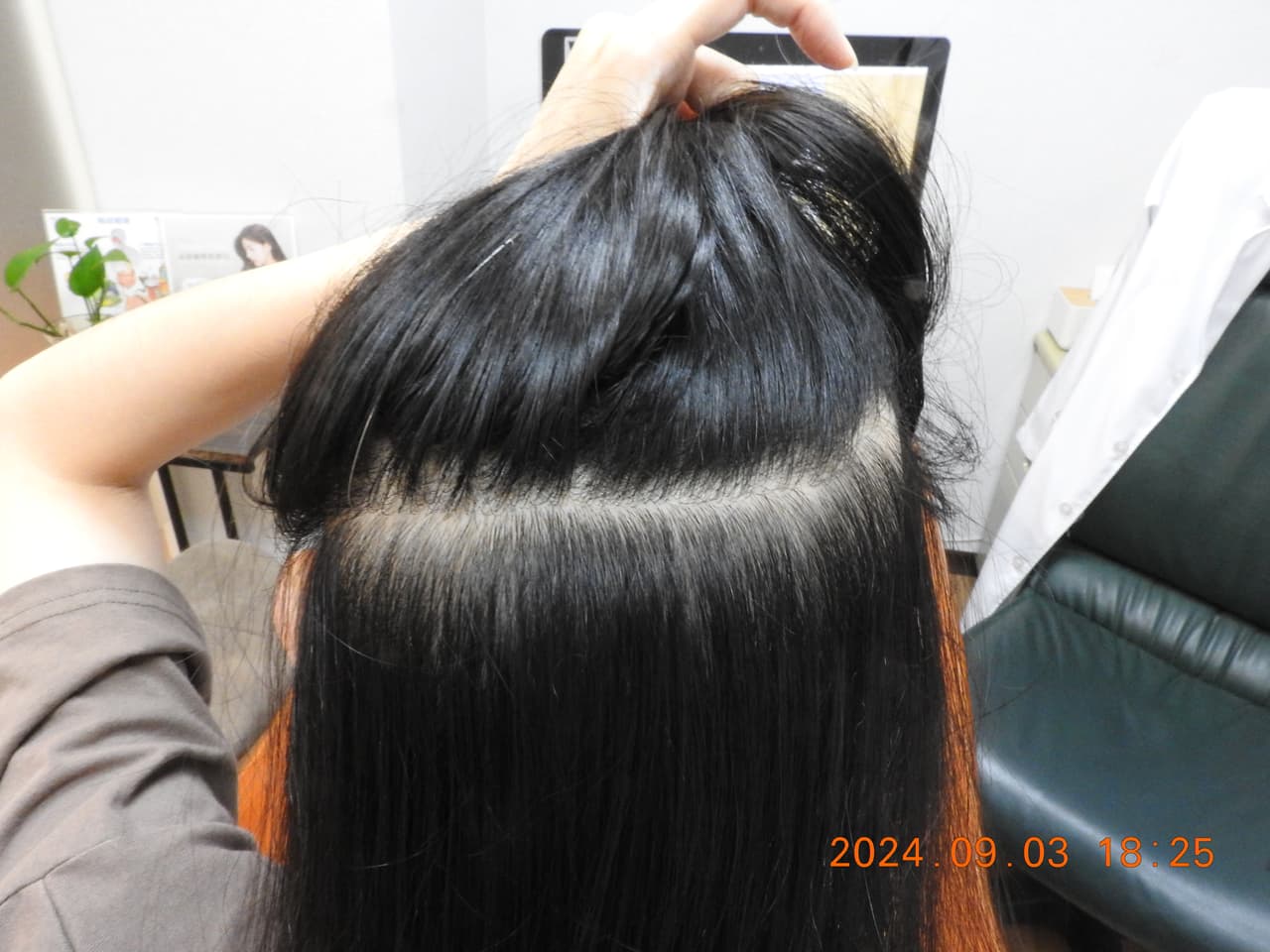 megapx