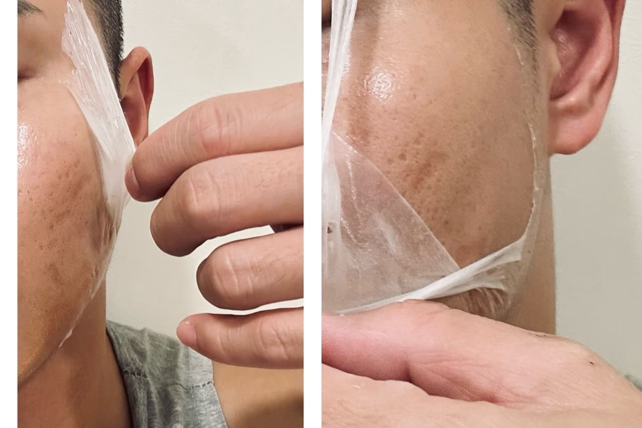 megapx
