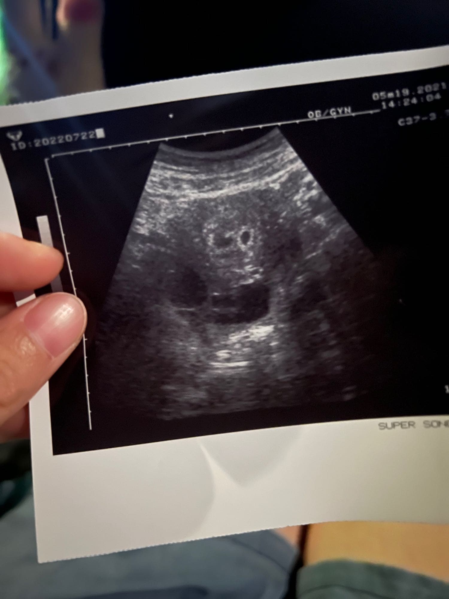 #懷孕謝謝你們選擇我當媽媽❤️ - 親子板| Dcard