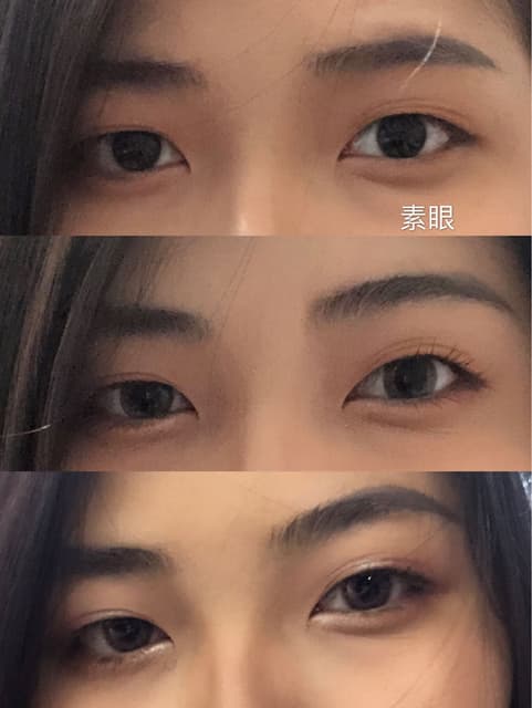 心得台中新彩雙眼皮手術 美妝板 Dcard