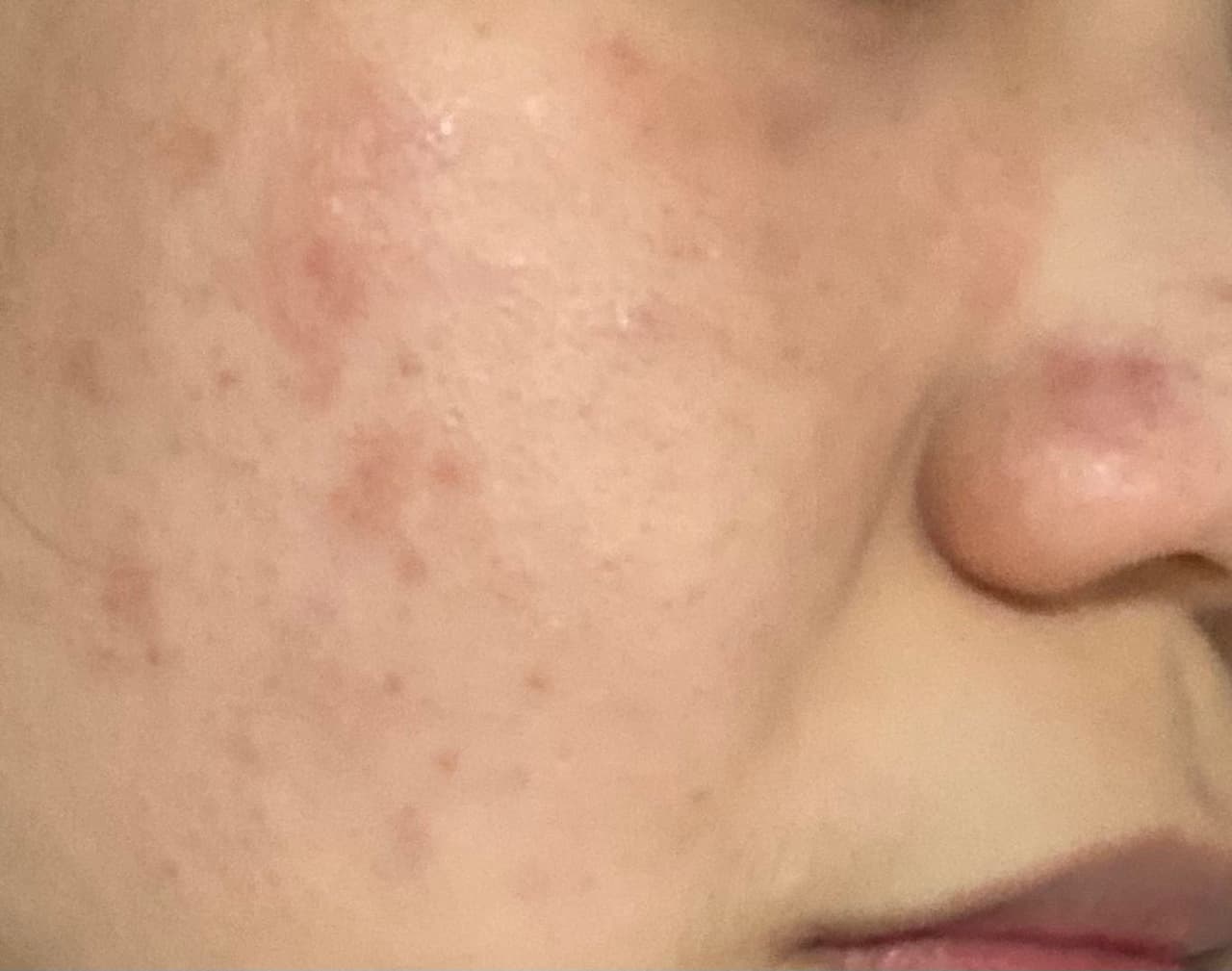 megapx