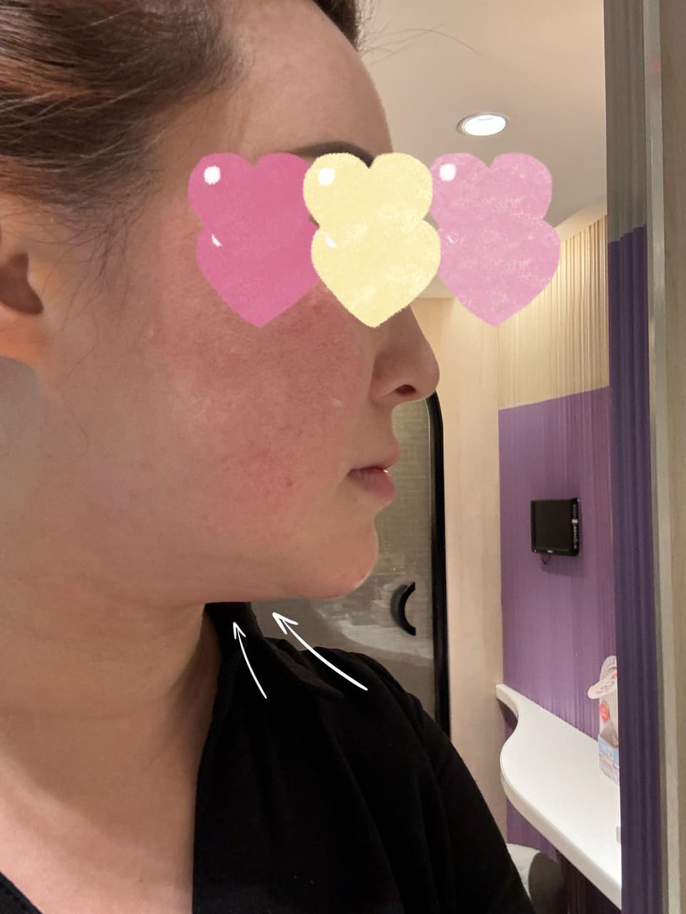 megapx