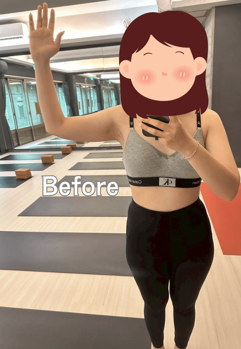megapx