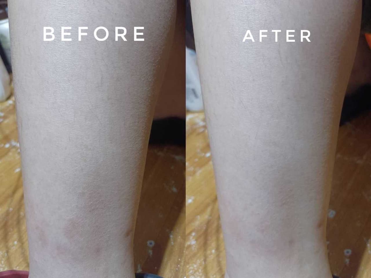 megapx
