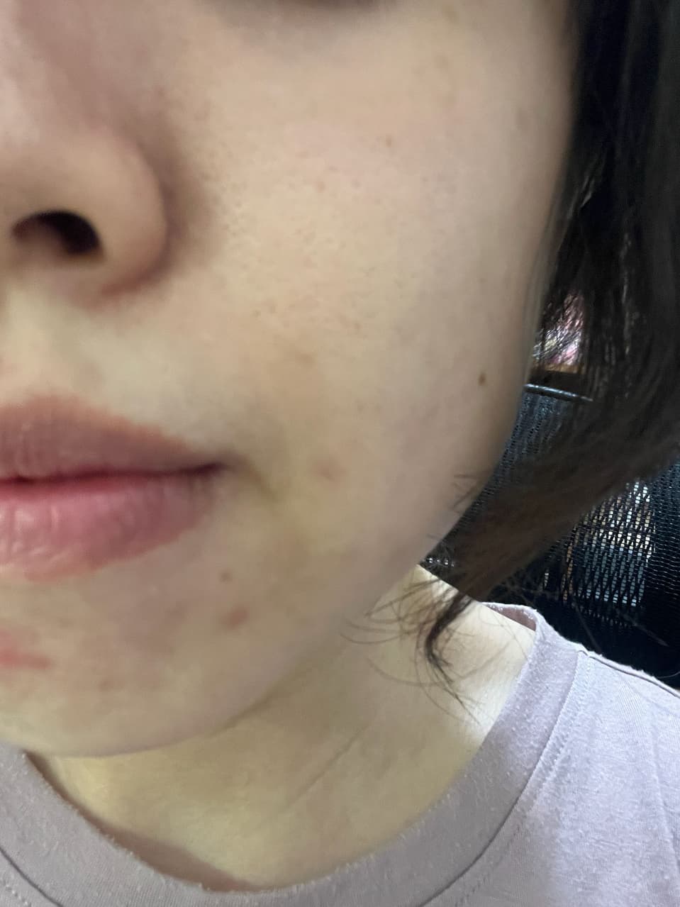 megapx