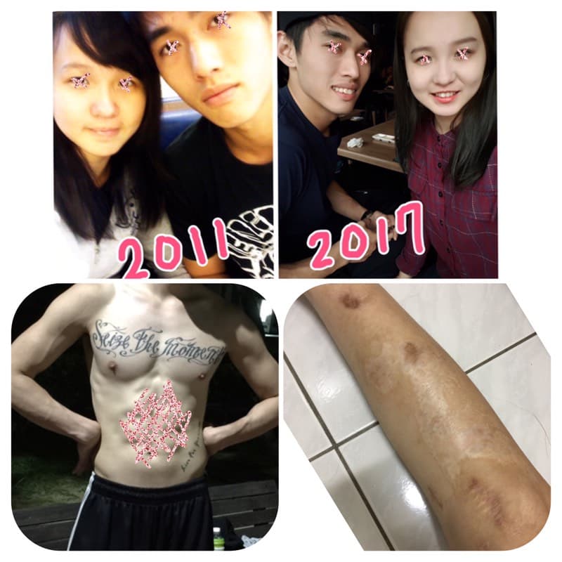 megapx