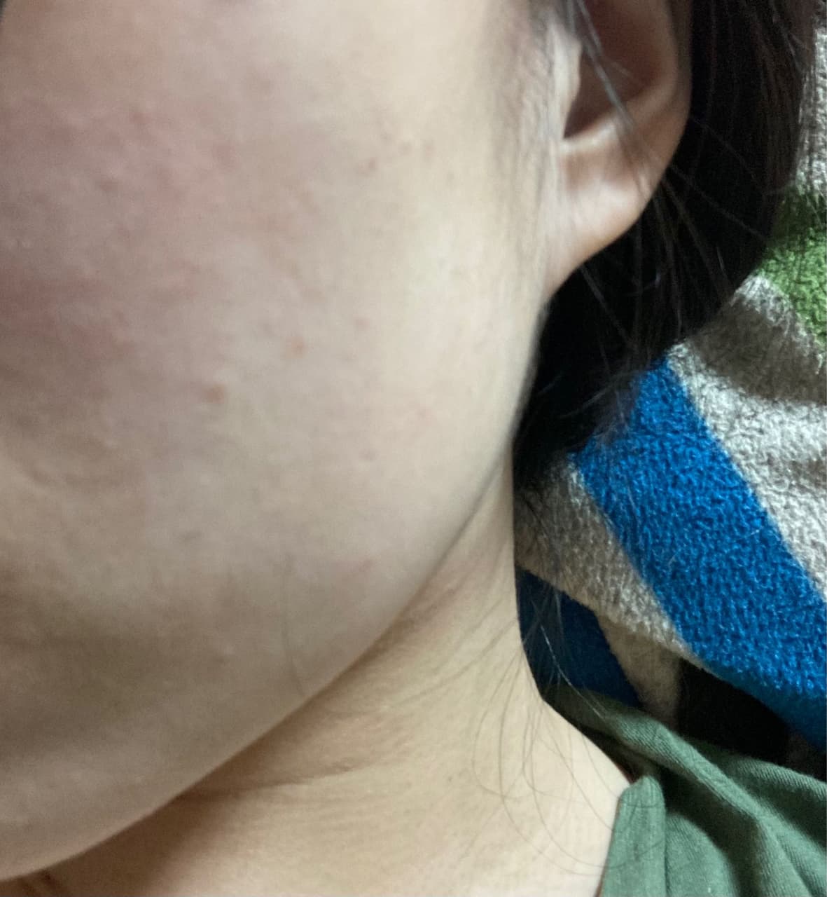 megapx