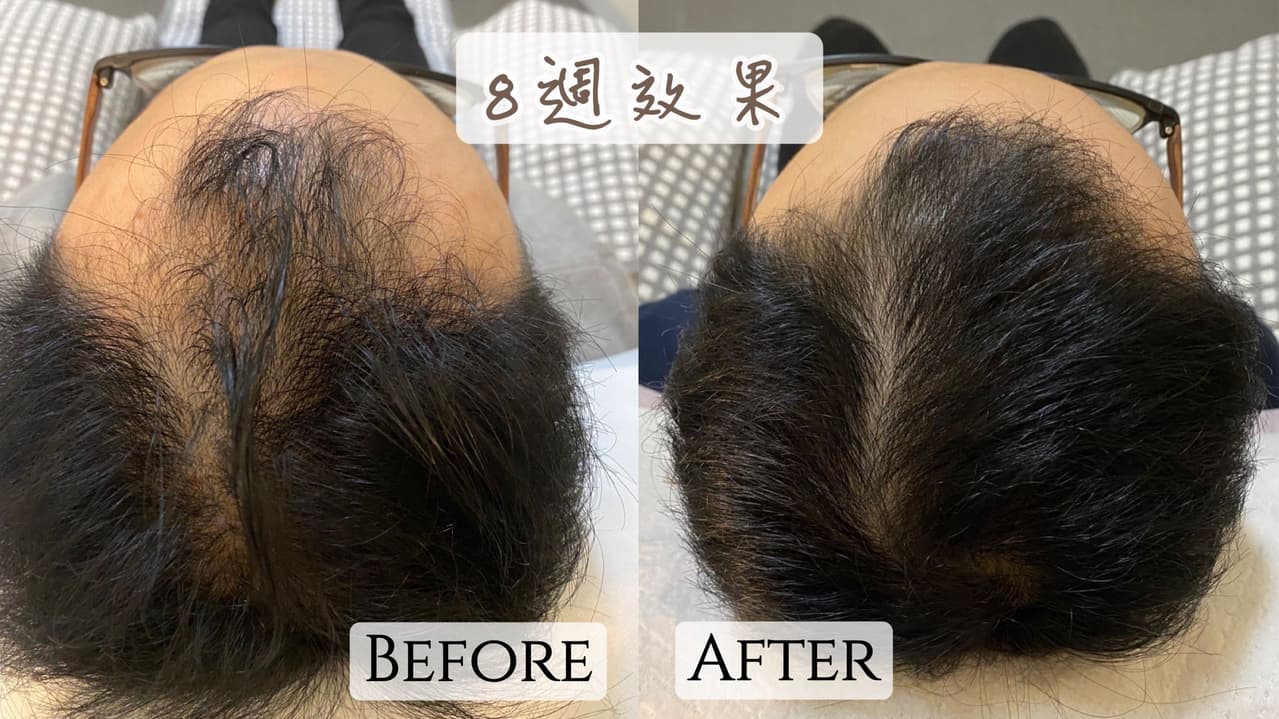 megapx