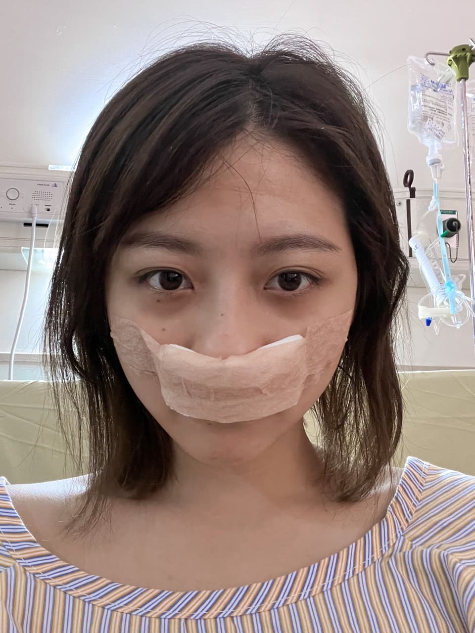 鼻中隔彎曲手術 記錄📝 - 心情板 | Dcard