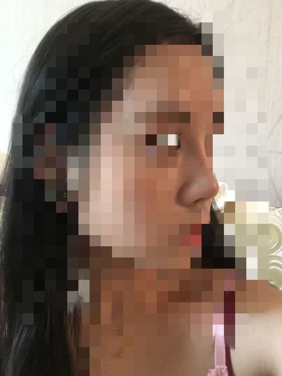 megapx